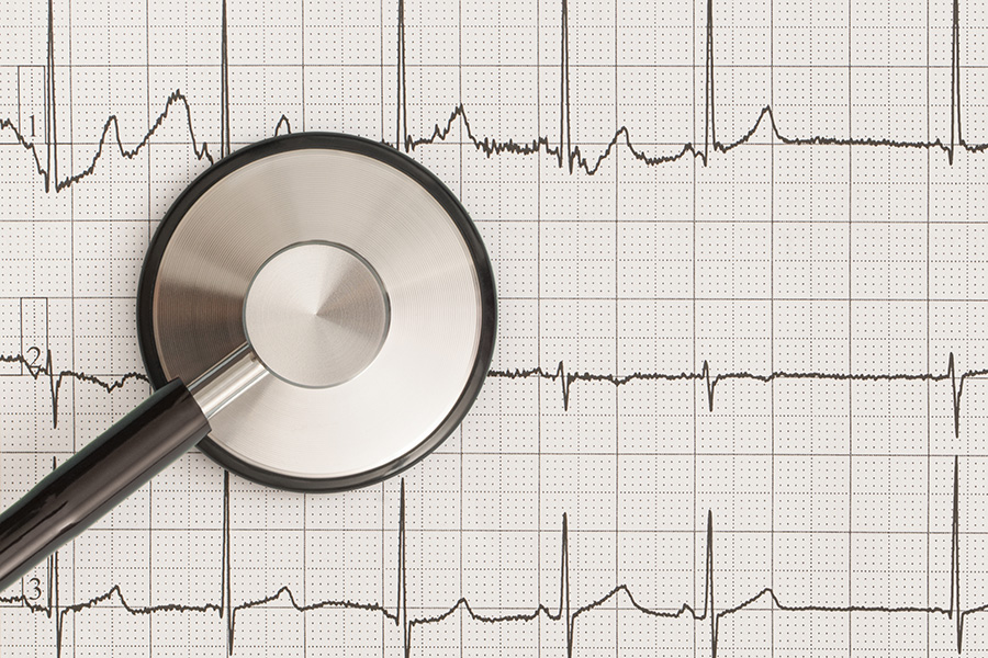 Ventricular Fibrillation